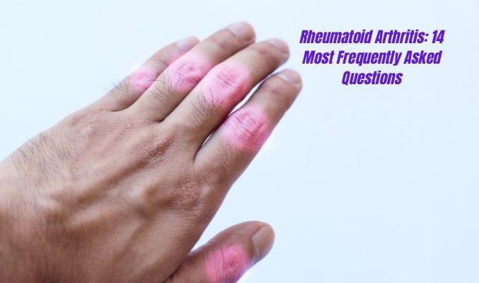 Rheumatoid Arthritis: 14 Most Frequently Asked Questions